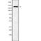 E3 ubiquitin-protein ligase RBBP6 antibody, abx218214, Abbexa, Western Blot image 