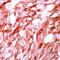 S100 Calcium Binding Protein A1 antibody, PA1-38585, Invitrogen Antibodies, Immunohistochemistry paraffin image 