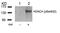 Histone Deacetylase 4 antibody, 79-468, ProSci, Western Blot image 