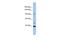 Leucine Rich Repeat Containing 37B antibody, A16658, Boster Biological Technology, Western Blot image 