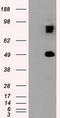 Proteasome 26S Subunit, ATPase 3 antibody, LS-C114983, Lifespan Biosciences, Western Blot image 