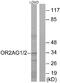 Olfactory Receptor Family 2 Subfamily AG Member 2 antibody, A30865, Boster Biological Technology, Western Blot image 