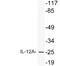 Interleukin-12 subunit alpha antibody, A00918, Boster Biological Technology, Western Blot image 