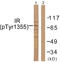 Insulin Receptor antibody, LS-C199130, Lifespan Biosciences, Western Blot image 