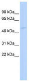 Heat Shock Transcription Factor Family, X-Linked 2 antibody, TA339484, Origene, Western Blot image 
