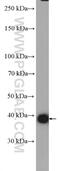 G Protein Subunit Alpha Q antibody, 13927-1-AP, Proteintech Group, Western Blot image 