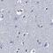 Transmembrane Protein 72 antibody, NBP1-90808, Novus Biologicals, Immunohistochemistry paraffin image 