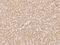 Exosome Component 2 antibody, GTX02229, GeneTex, Immunohistochemistry paraffin image 