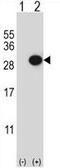 Collagen Triple Helix Repeat Containing 1 antibody, GTX81033, GeneTex, Western Blot image 