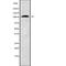 Zinc Finger And BTB Domain Containing 21 antibody, abx219401, Abbexa, Western Blot image 