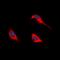 Protein Kinase C Alpha antibody, orb315662, Biorbyt, Immunofluorescence image 