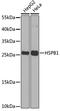 Heat Shock Protein Family B (Small) Member 1 antibody, 13-100, ProSci, Western Blot image 