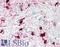 Crystallin Alpha B antibody, LS-B3410, Lifespan Biosciences, Immunohistochemistry frozen image 