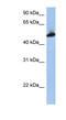Tubulin Beta 2A Class IIa antibody, 25-591, ProSci, Enzyme Linked Immunosorbent Assay image 