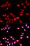 Regulator Of Calcineurin 1 antibody, LS-C333986, Lifespan Biosciences, Immunofluorescence image 