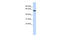 Gamma-Aminobutyric Acid Type A Receptor Beta3 Subunit antibody, ARP35339_P050, Aviva Systems Biology, Western Blot image 