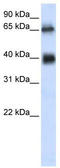 Zinc Finger Containing Ubiquitin Peptidase 1 antibody, TA330227, Origene, Western Blot image 