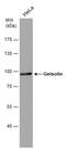 Gelsolin antibody, GTX633675, GeneTex, Western Blot image 