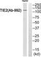 TEK Receptor Tyrosine Kinase antibody, TA313334, Origene, Western Blot image 