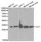 Enoyl-CoA Delta Isomerase 1 antibody, PA5-75997, Invitrogen Antibodies, Western Blot image 