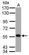 Tyrosine-protein kinase Tec antibody, GTX118997, GeneTex, Western Blot image 