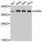 Neugrin, Neurite Outgrowth Associated antibody, STJ114025, St John