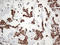 EWS RNA Binding Protein 1 antibody, LS-C793180, Lifespan Biosciences, Immunohistochemistry paraffin image 