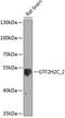 GTF2H2 Family Member C, Copy 2 antibody, 23-494, ProSci, Western Blot image 