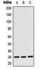 Casein Kinase 1 Alpha 1 Like antibody, MBS8200832, MyBioSource, Western Blot image 