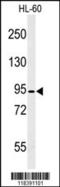 CAPN3 antibody, MBS9209841, MyBioSource, Western Blot image 