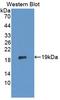 Endoplasmic reticulum resident protein 29 antibody, LS-C663224, Lifespan Biosciences, Western Blot image 