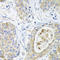 Glutathione S-Transferase Alpha 2 antibody, A04171, Boster Biological Technology, Immunohistochemistry paraffin image 