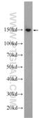 Scaffold Attachment Factor B antibody, 21857-1-AP, Proteintech Group, Western Blot image 