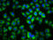 Melanocortin 1 Receptor antibody, LS-C670652, Lifespan Biosciences, Immunofluorescence image 