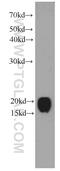 Canopy FGF Signaling Regulator 2 antibody, 66173-1-Ig, Proteintech Group, Western Blot image 