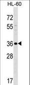 SPARC (Osteonectin), Cwcv And Kazal Like Domains Proteoglycan 3 antibody, LS-C157079, Lifespan Biosciences, Western Blot image 