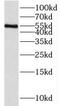 Interleukin 1 Receptor Associated Kinase 4 antibody, FNab10221, FineTest, Western Blot image 