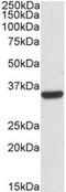 Calponin 2 antibody, MBS421943, MyBioSource, Western Blot image 