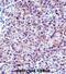 Chymotrypsin Like Elastase 3A antibody, abx028089, Abbexa, Immunohistochemistry paraffin image 