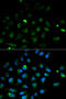 Perforin 1 antibody, 13-029, ProSci, Immunofluorescence image 
