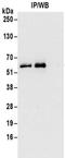 RB2K antibody, NBP2-32162, Novus Biologicals, Immunoprecipitation image 