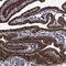 EYA Transcriptional Coactivator And Phosphatase 4 antibody, NBP1-85548, Novus Biologicals, Immunohistochemistry paraffin image 