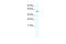 Sp1 Transcription Factor antibody, ARP37192_T100, Aviva Systems Biology, Western Blot image 