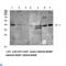 Killer Cell Immunoglobulin Like Receptor, Three Ig Domains And Long Cytoplasmic Tail 1 antibody, LS-C813363, Lifespan Biosciences, Immunohistochemistry paraffin image 