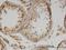 Interleukin 13 antibody, H00003596-M07, Novus Biologicals, Immunohistochemistry frozen image 