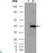 Betaine--Homocysteine S-Methyltransferase antibody, LS-C812402, Lifespan Biosciences, Immunohistochemistry paraffin image 
