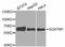 Sequestosome 1 antibody, LS-C746989, Lifespan Biosciences, Western Blot image 