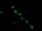 Zinc Finger And SCAN Domain Containing 18 antibody, M14039, Boster Biological Technology, Immunofluorescence image 