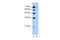 Afadin, Adherens Junction Formation Factor antibody, A03405, Boster Biological Technology, Western Blot image 