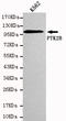 Protein Tyrosine Kinase 2 Beta antibody, LS-C178276, Lifespan Biosciences, Western Blot image 